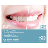 SD Naturals Professional Whitening Kit Before/After